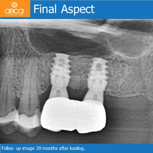 Clinical Case