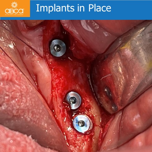 Clinical Case