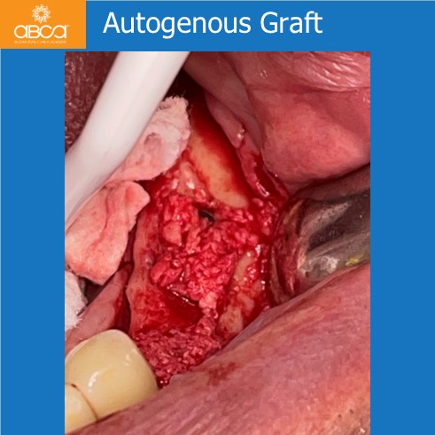 Clinical Case