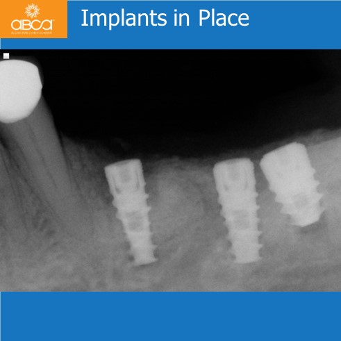 Clinical Case