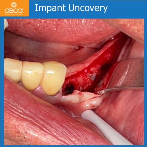 Clinical Case