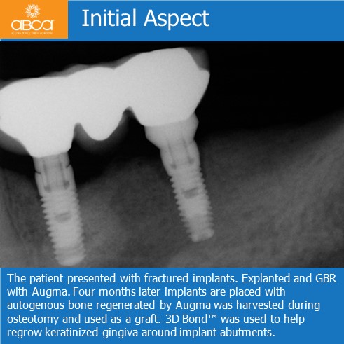 Clinical Case