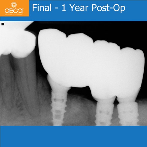 Clinical Case