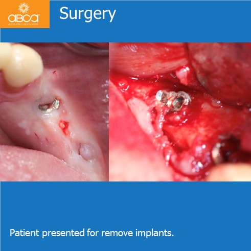 Clinical Case