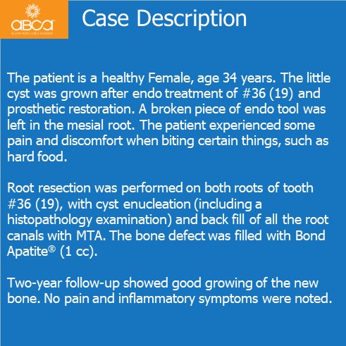 Clinical Case