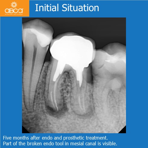 Clinical Case