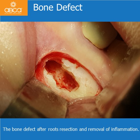 Clinical Case