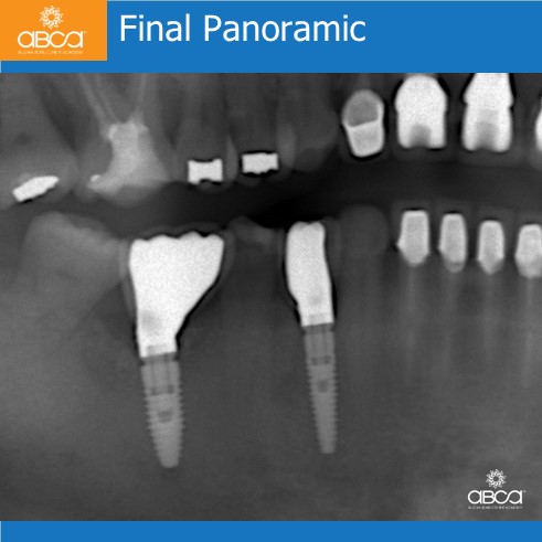 Clinical Case