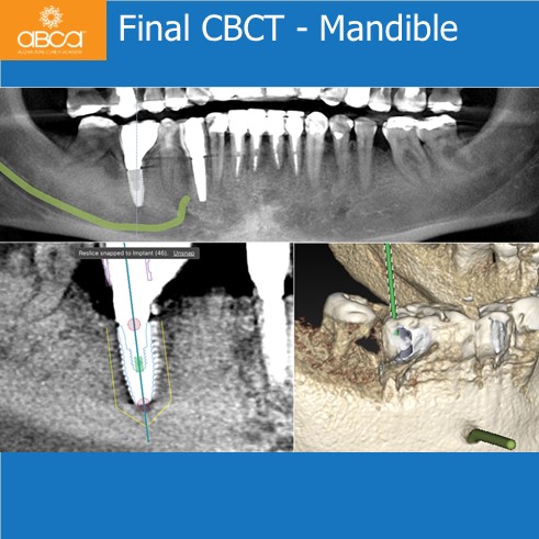 Clinical Case