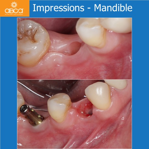 Clinical Case