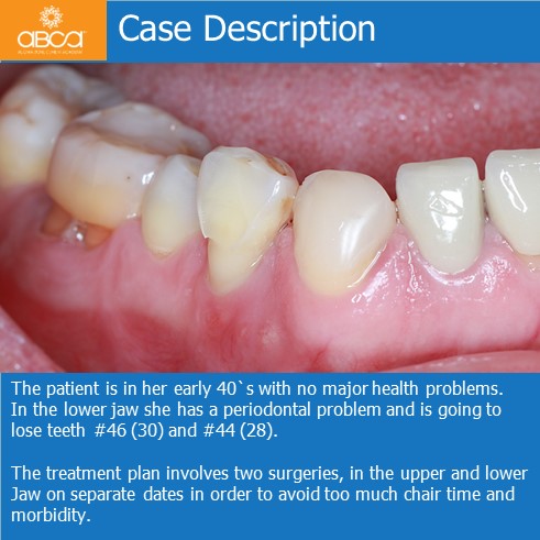 Clinical Case