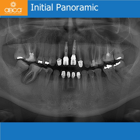 Clinical Case