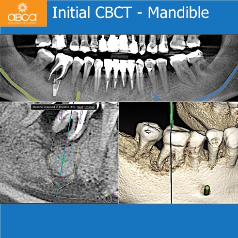 Clinical Case