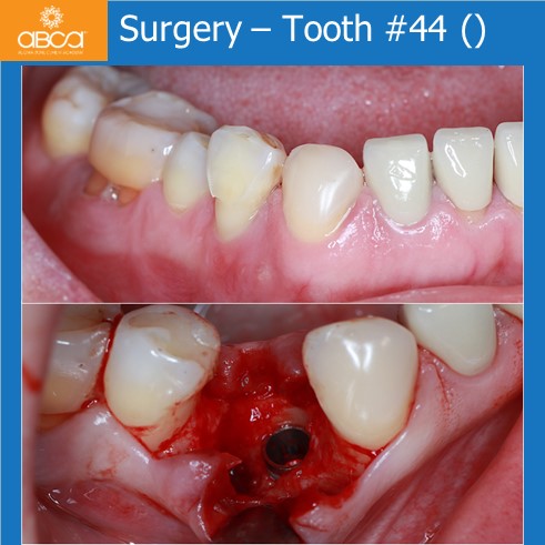 Clinical Case