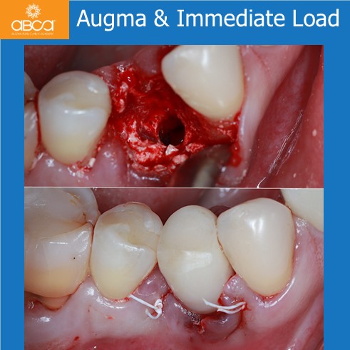 Clinical Case