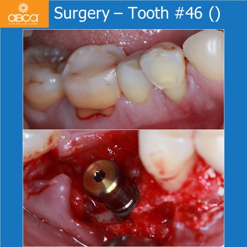 Clinical Case