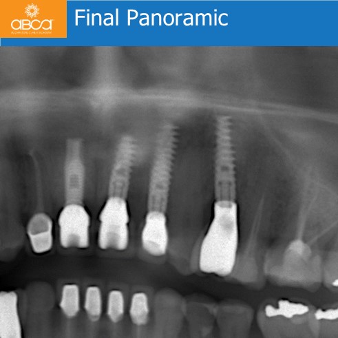 Clinical Case