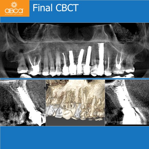 Clinical Case