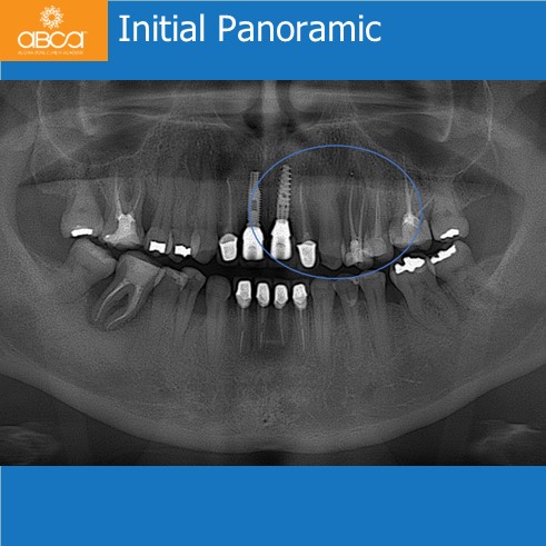 Clinical Case