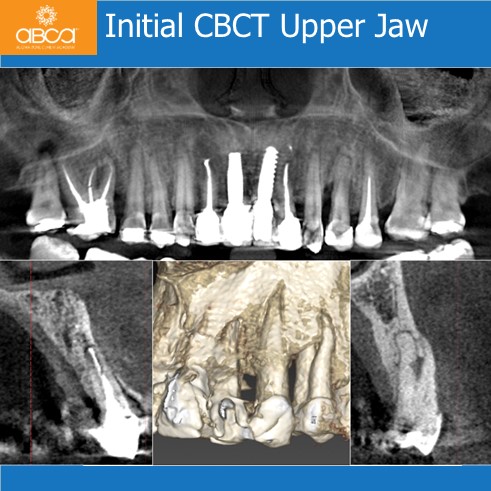 Clinical Case