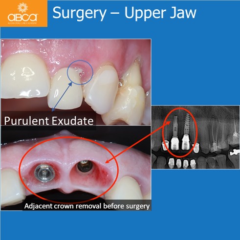 Clinical Case