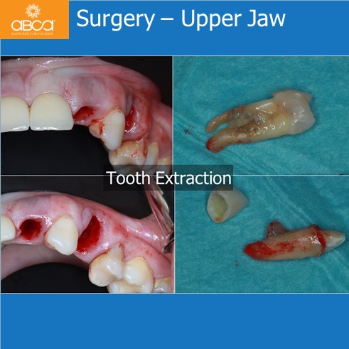 Clinical Case