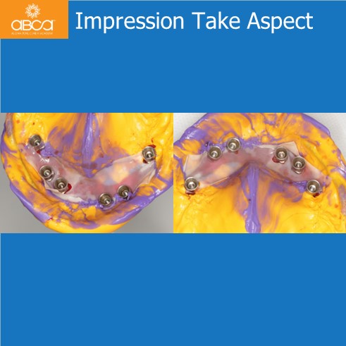 Impression Take Aspect