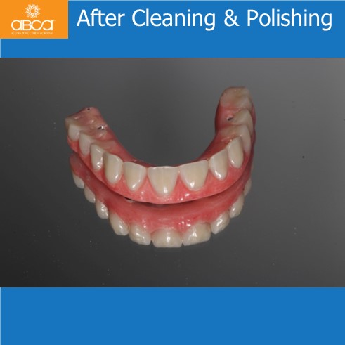 After Cleaning & Polishing