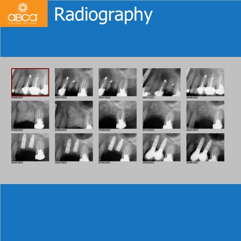 Radiography