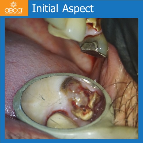 Initial Aspect