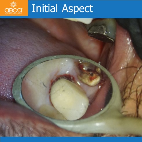 Initial Aspect