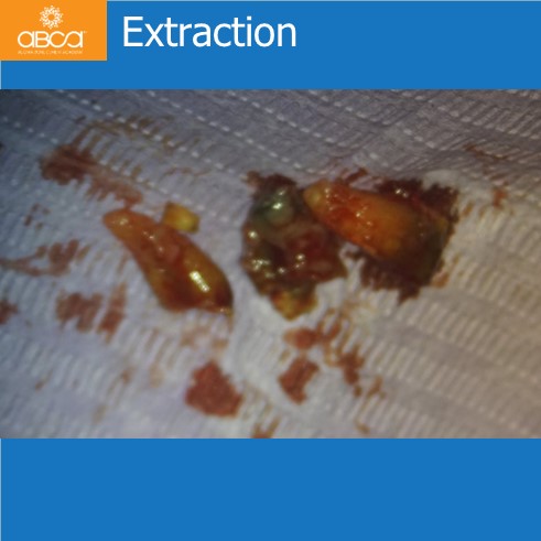 Extraction