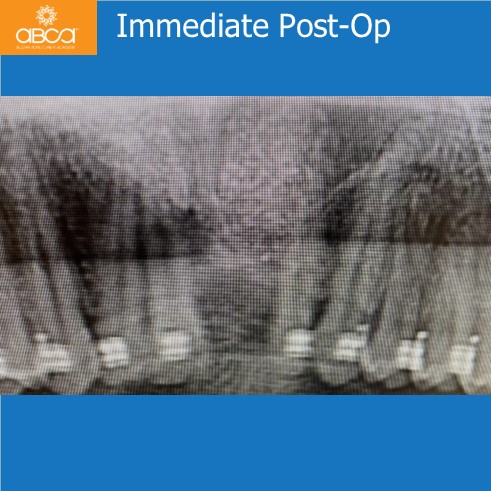 Clinical Case