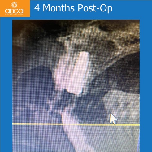 Clinical Case