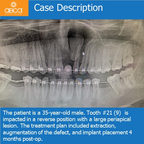 Clinical Case