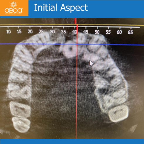 Clinical Case