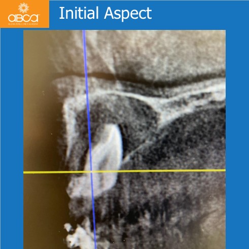 Clinical Case