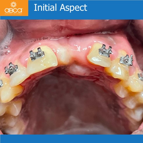 Clinical Case