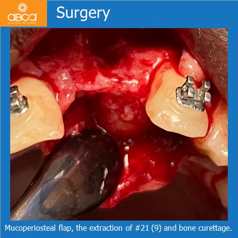 Clinical Case