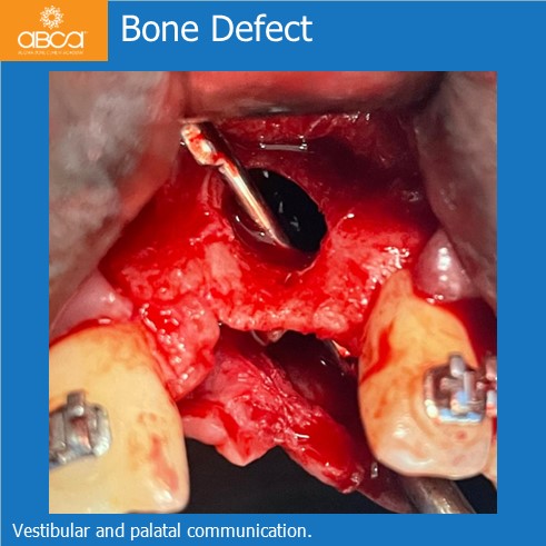 Clinical Case