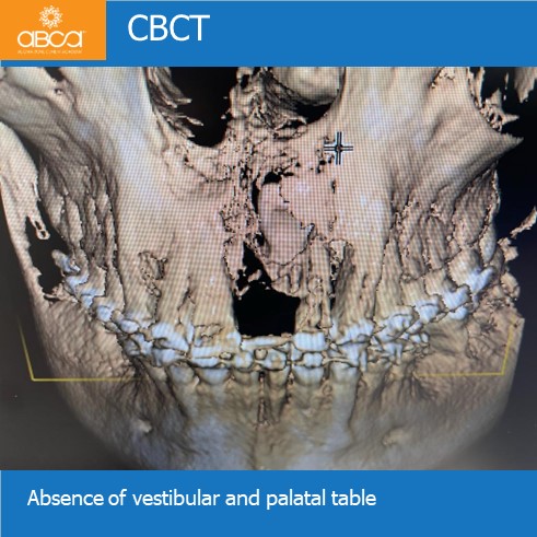 Clinical Case