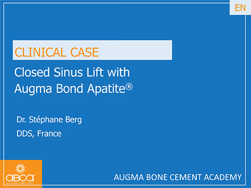 Closed Sinus Lift with Augma Bond Apetite