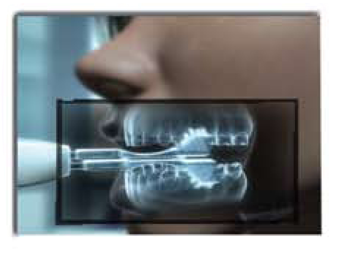 Hydrabrush Powered Toothbrush Xray View