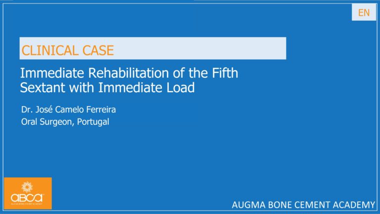 Immediate Rehabilitation of the Fifth Sextant with Immediate Load