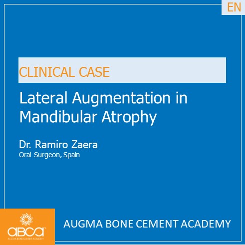 Lateral Augmentation in Mandibular Atrophy