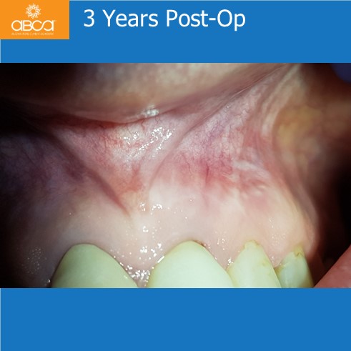 Little Cyst #21 (9)