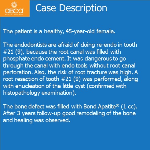 Little Cyst #21 (9)