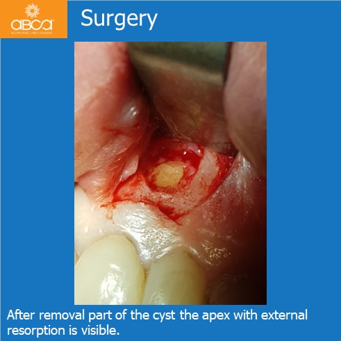Little Cyst #21 (9)