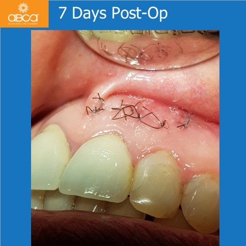 Little Cyst #21 (9)