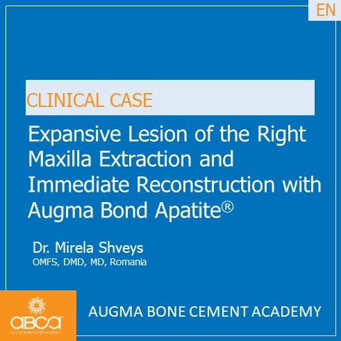 Expansive Lesion of the Right Maxilla Extraction and Immediate Reconstruction with Augma Bond ApatiteŽ